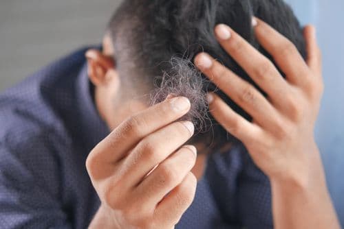 The First Signs of Hair Loss