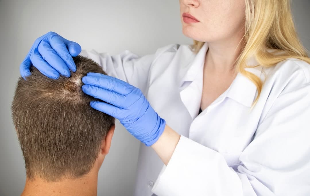 Defining Trichology—The Study of Hair Loss